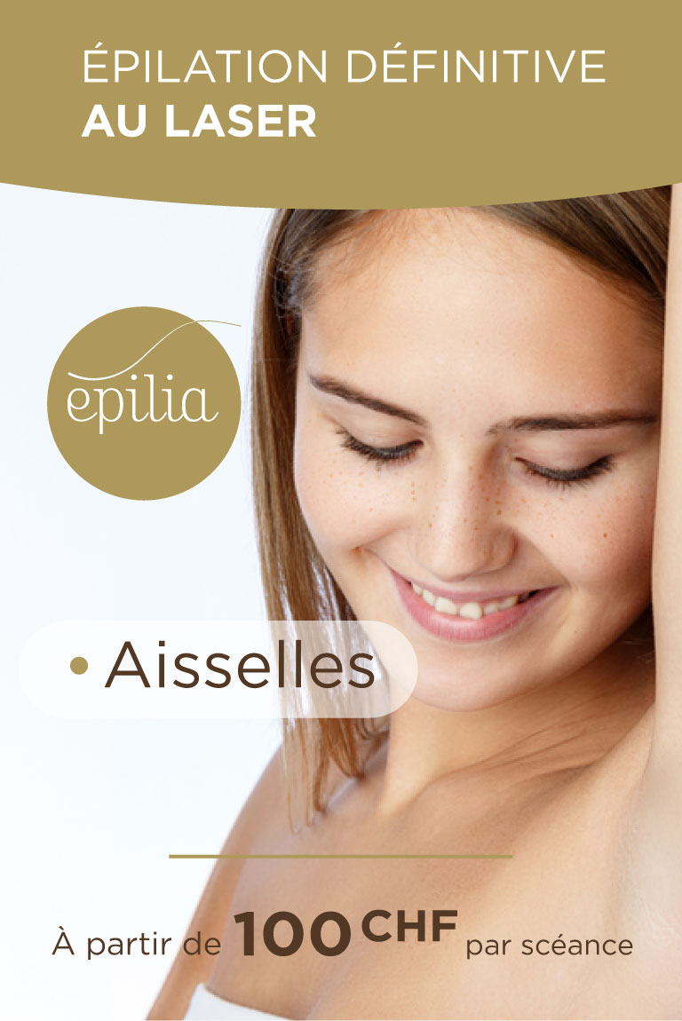 prix-epilation-laser-aisselles-lausanne-mob