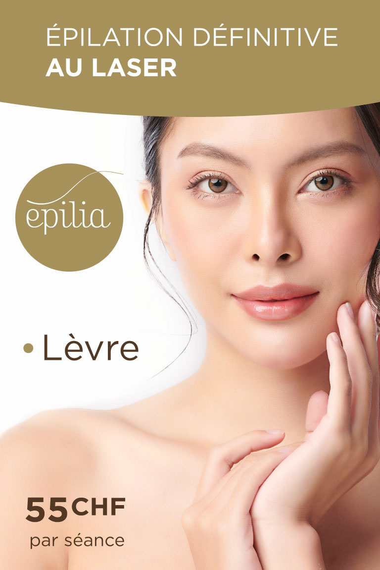 prix-epilation-laser-levre-lausanne-mob